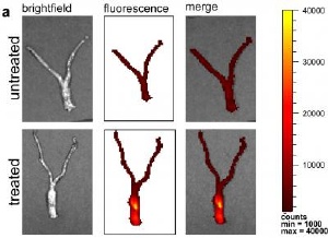 Distribution of nanoparticles seen by fluorescence throughout mouse reproductive tract. Credit: Woodrow/Yale