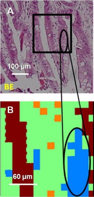 Visible light micrograph of Barrett