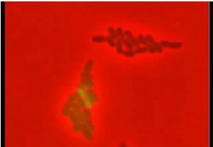 In this colony, the bacteria lighting up in green are those being "turned on," while those in red remain "off." Credit: Lingchong You