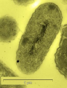 A C. metallidurans ultra-thin section containing a gold nanoparticle. (Credit: Reith et al, PNAS 5-9 October 2009.)