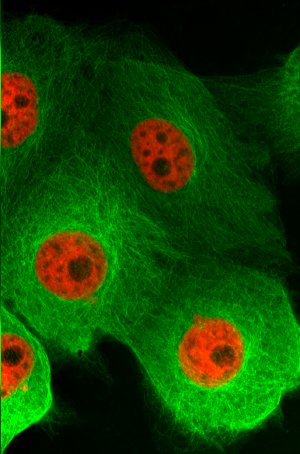 Epithelial cells of a pig’s kidney (LLC-PK1), marked with Tubulin-Emerald and H2B-mCherry, photographed with the VivaTome microscope module and the 63x/1.4 Plan-APOCHROMAT objective lens from Carl Zeiss.