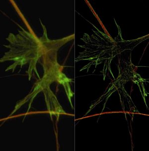 Photograph of neuronal growth cone with widefield microscopy (left) and SR-SIM, staining for tubulin (red) and F-actin (green). Specimen: M. Fritz and M. Bastmeyer, University of Karlsruhe (TH), Germany.