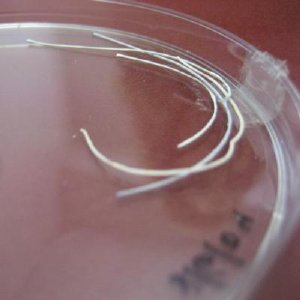 These are composite drug-releasing fibers used as basic elements of scaffolding for tissue and bone regeneration. Credit: AFTAU