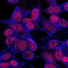 Mouse tumor cells stain red, showing penetration of anti-cancer drug after 24 hours. | Pratt School of Engineering