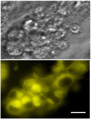 Fluorescent microscope images of unstained pancreatic alpha cells (top) and the same cells 24 hours after staining with glucagon yellow (bottom) (scale bar, 20 µm). Reproduced from Ref. 1 © 2009 The American Chemical Society