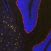 Shown is a multi-labeled Qdot image of Neuropeptide Y (NPY) and Calbindin 1 (Calb1) in a C57BL6/J mouse brain. Calb1 expression can be seen labeled in red (streptavidin-QD655) within the Purkinje layer of the cerebellum. NPY cortical expression is shown in Gold, (streptavidin-QD585).