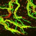 In diseases such as multiple sclerosis, cells of the immune system infiltrate the brain tissue, where they cause immense damage. For many years, it was an enigma as to how these cells can escape from the bloodstream. 