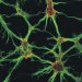 Researchers in London have found that nanometer size diamonds can be attached to a wide range of substrates and that they can promote the growth of neurons without the need for the complex layers of proteins normally required. 