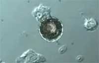 Nanotechnology and Drug Delivery