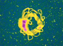 AZoNano - The A to Z of Nanotechnology - Condensed deoxyribonucleic acid (DNA) has been proposed as a gene delivery mechanism for biotechnology applications. Here, unfixed molecules were imaged in salt solution. 20μm scan.