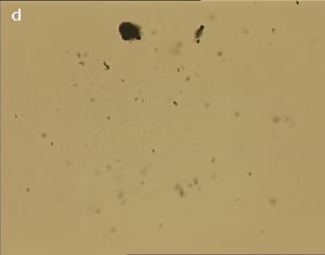 Dispersion of carbon nanotubes using optical tweezer cum microdissection combi system (field of view 80µm).