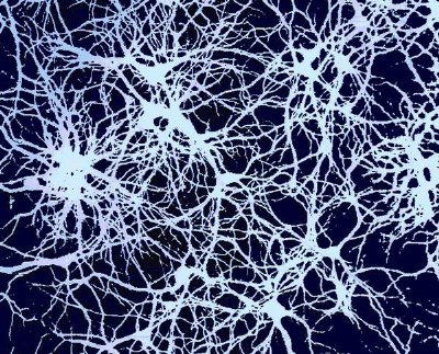 Computers modeled on the brain