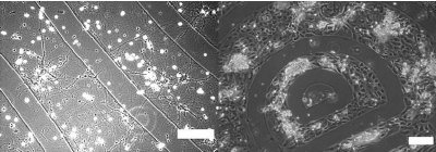 Microscope Images of Hippocampal cells day 20 of the culture (left panel) and neonatal cardiac myocytes day 100 of the culture (right panel). Scale bar depicts 100 µm.