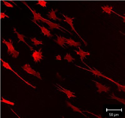 Enhanced growth of preosteoblast cells on nanostructured titanium (top) as compared to coarse-grained one (bottom). Note the morphology of the cells on nanostructured Ti indicating their better viability.