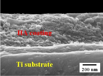 SEM micrographs of surface-modified titanium implants: Morphology of MAO treated surface (top) , anodized surface (middle) and cross-sectional view of HA coating on Ti substrate (bottom).