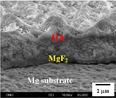Coating layers of MgF2 and hydrohyapatite (HA) on Mg (top) and osteoblast cells attached on the surface of Mg coated with MgF2 and HA (bottom).