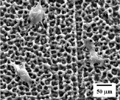 Coating layers of MgF2 and hydrohyapatite (HA) on Mg (top) and osteoblast cells attached on the surface of Mg coated with MgF2 and HA (bottom).