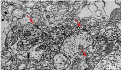 Single 30 nm thick section of mouse brain imaged with backscattered electrons at 8 kV using a Zeiss Sigma FE-SEM. Original image resolution was 4 nm per pixel. Red arrows point to areas where one neuron contacts and transfers information to another.
