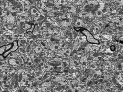 Rat hippocampus zoom images from a single tile of 24 k × 24 k pixels.