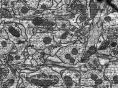 Rat hippocampus zoom images from a single tile of 24 k × 24 k pixels.