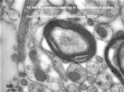 The STEM image of 10 nm immunogold labeled rat hypothalamus in Lowicryl HM20 epoxy, no post stain.