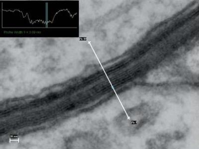 The STEM image of a myelinated axon sheath in unstained rat hippocampus ultra section with 3 nm spacing.