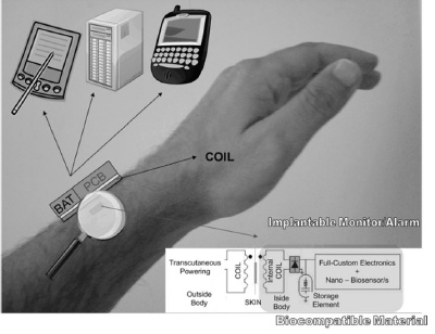 Conception of the implantable device.