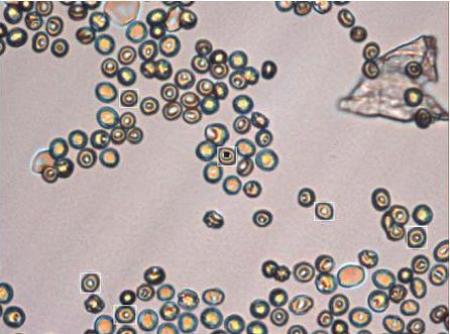 Magnified red blood cells