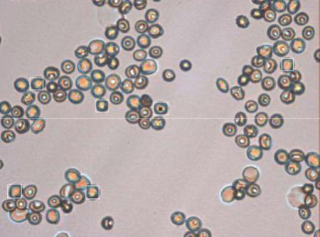 Magnified red blood cells