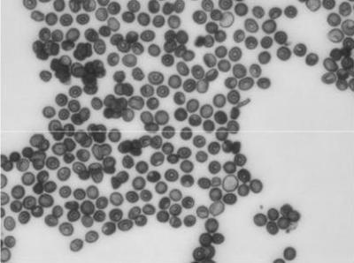 415 nm imaging