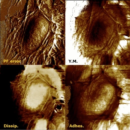 75x75µm BioScope Catalyst and PeakForce QNM image of living HaCat cells under oxidative stress. The cells react by rapidly