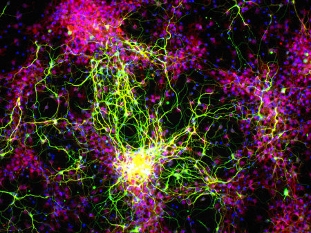 Stem cells can be used to regrow damaged tissue in many areas of the body. Nanoscale scaffolds can improve results of stem cell therapy by guiding this growth in the right direction.