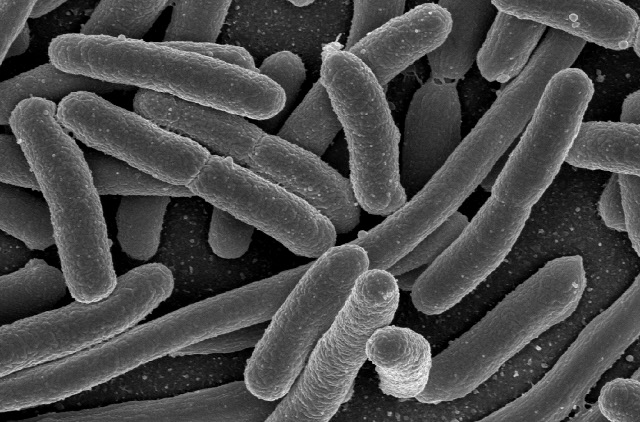 SEM image of E. coli cells.