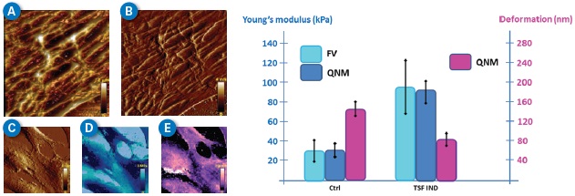 PeakForce QNM investigation of live U-251 Glioblastoma cells. (A and B) 20x20pm 512x512 3D-rendered height and peak force error images respectively of control cells. The loading force has been increased on purpose to reveal high-resolution details of the cell cytoskeleton (typical capture time = 35 minutes). (C, D and E) Peak force error, Young