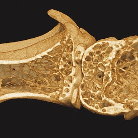 In vivo scan of mouse hindlimb (knee) with 9 µm pixel size