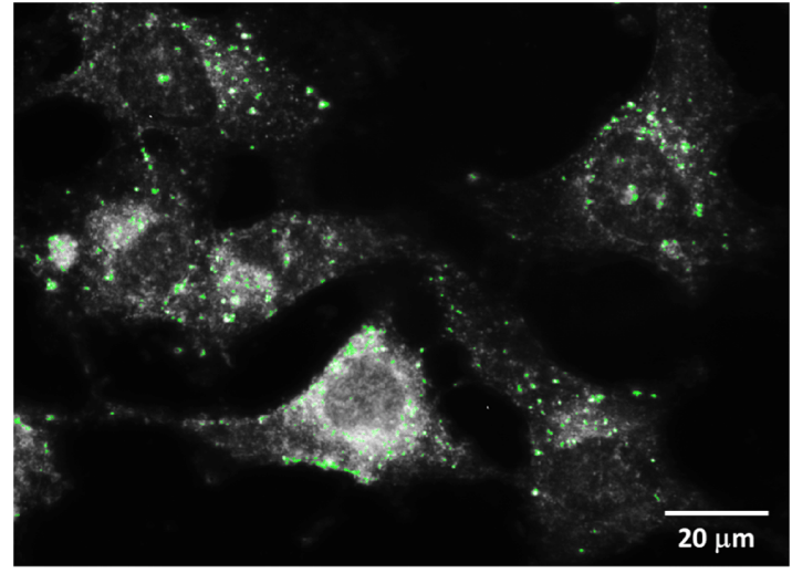 Manochromatic image at 550 nm. GNPs marked in green after PCA.