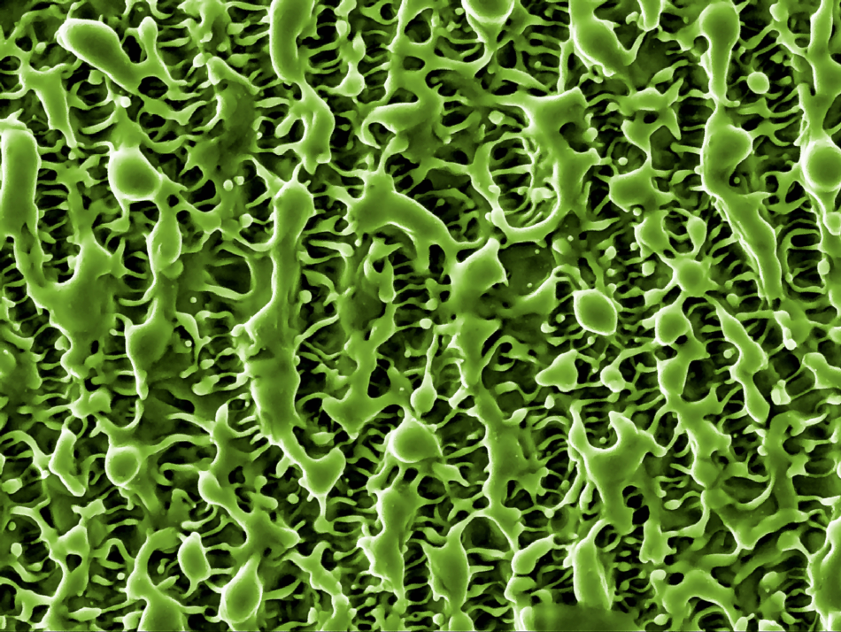Nickel Nanostructured Surface