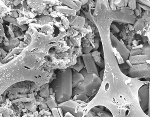 Tenocytes on calcium phosphate after seven days of growth.