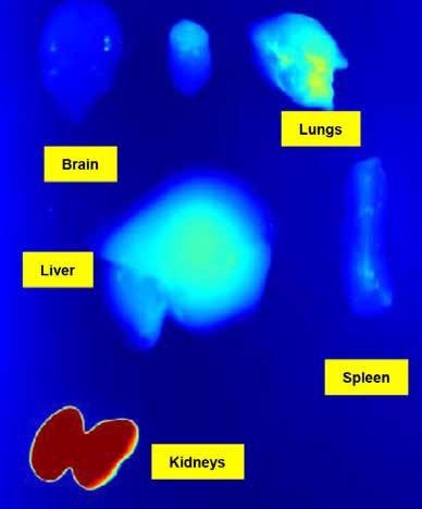 Studies ex vivo won’t be necessary anymore to get the biodistribution data in each organ. Image courtesy of the Preclinical Imaging Laboratory of the National Research Center in Ottawa