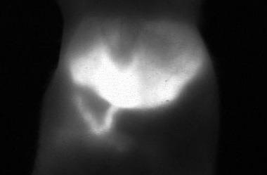 Picture of mouse liver 22 minutes after injection of ICG: the image is taken from a video that shows the metabolism and hepatobiliary elimination of ICG into the intestine as well as intestinal contractions