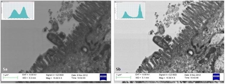 Analysis of images in Joubert5 indicates a 15% increase in contrast of thin sections of Helicobacter pylori on Caco-2 cells after plasma cleaning.