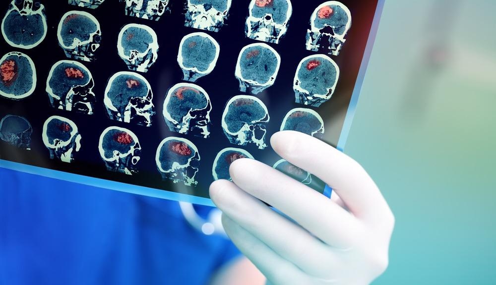 brain, graphene bioelectronics