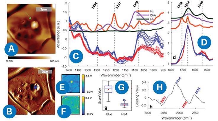 AFM-IR imaging of a P. falciparum trophozoite inside a red blood cell. (A) AFM topography. (B) AFM deflection map showing the location of the points where spectra were measured, inside (blue) and outside (red) of the protrusion. (C, D) Spectra measured from the signal of the IR intensity peak (V) showing different bands for the red and blue spots in the 1450-950 and 1800-1450 cm-1 regions, respectively. (E, F) IR peak maps obtained at 1207 and 1660 cm-1, respectively. (G, H) Score and loading plots from the PCA applied to the 3100-2800 cm-1 region. D. Perez-Guaita, K. Kochan, M. Batty, C. Doerig, J. Garcia-Bustos, S. Espinoza, D. McNaughton, P. Heraud, and B.R. Wood. Anal. Chem. 90, 3140-3148 (2018)8