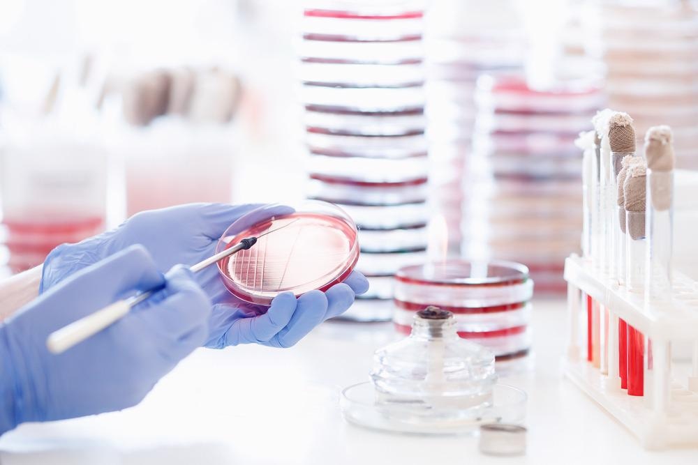 antimicrobial resistance, antibacterial, bacteria, green nanotechnology