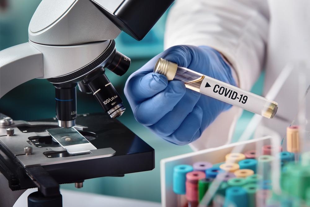 covid-19, sars-cov-2, carbon nanotubes, biosensor