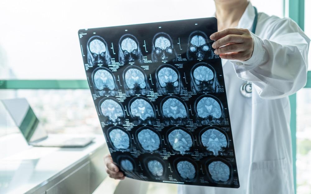 neurological research and gold nanoparticles