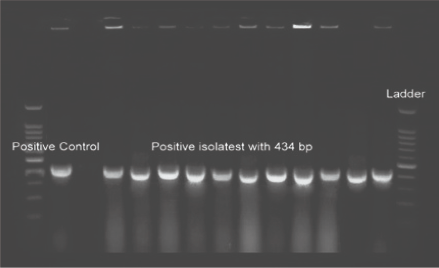 The Impact of Different-Sized Nanoparticles on Streptococcus Species