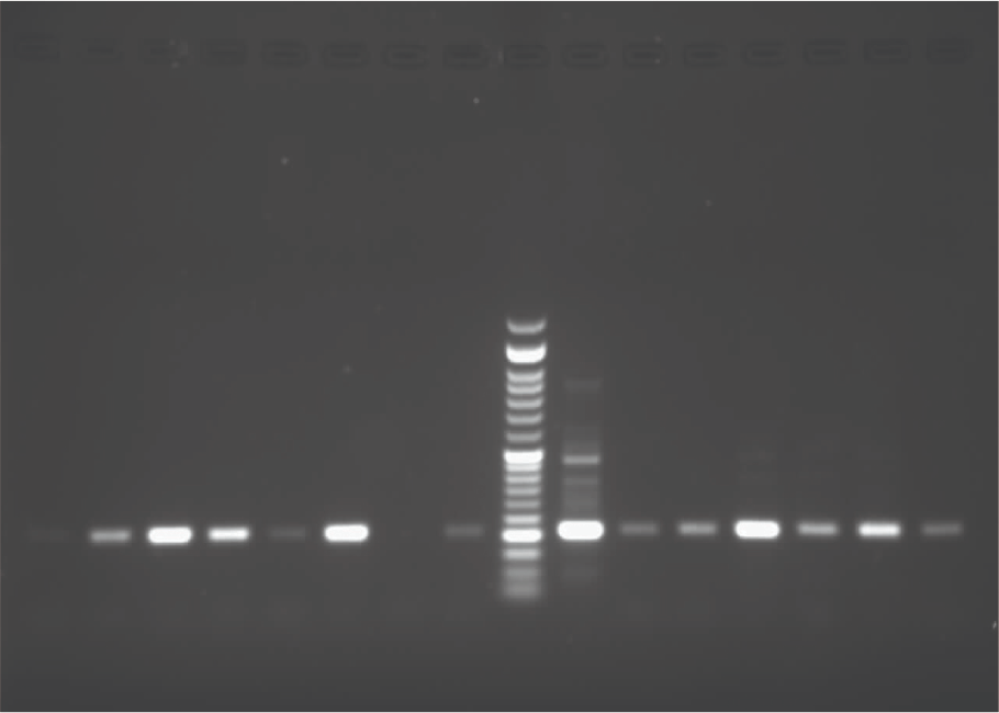 The Impact of Different-Sized Nanoparticles on Streptococcus Species