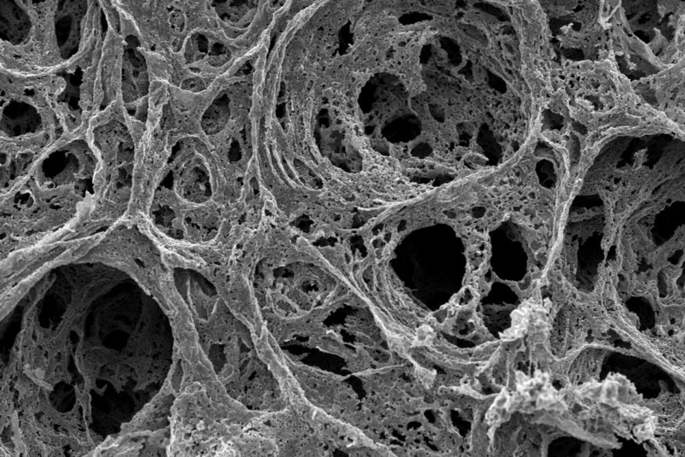 Nanoporous Metals in Energy Technologies: An Overview