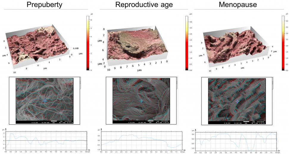 Architecture, topography and biomechanics synergy. 3D rendering of surface topography from stereoscopic reconstruction of two SEM images. Color scales indicate the height range on each surface. Scale on SEM micrographs corresponds to 1µm.
